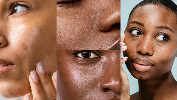 Why Skin Type Matters: Building the Best Skincare Routine for Your Skin